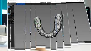 CS 3600 Access Intraoral Scanner  Streamhealth Dental [upl. by Lorna869]