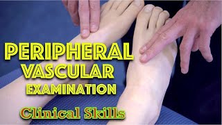 Peripheral Vascular Examination  Clinical Skills  Dr Gill [upl. by Emirak]