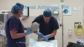 Vortex in Action Pt 2 Elective Intubation in OT [upl. by Kitti53]