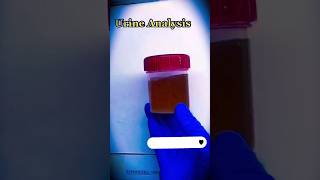 Urine Analysis Complete  Urine RE  bacteria microscope science 1millionviews viral shorts [upl. by Narih]