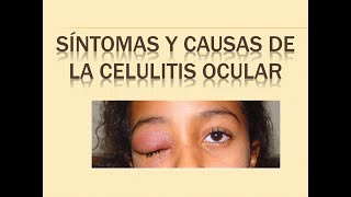 CELULITIS OCULAR  SINTOMAS Y CAUSAS [upl. by Aikem]