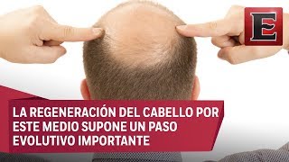 ¿Cómo combatir la alopecia con células madre [upl. by Caprice]