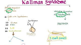 kallmannsyndromegnrhhypothalmusfshlh [upl. by Yate55]