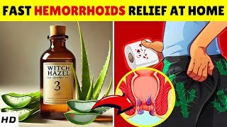 Say Goodbye to Hemorrhoids – 8 Home Remedies That Actually Work [upl. by Nodearb]