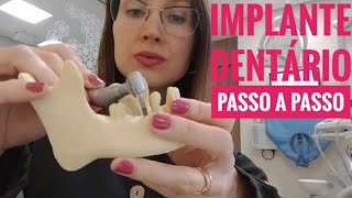 Implante Dentário Passo a Passo l Dra Danielle Sales [upl. by Anna-Diana259]