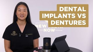 Dental Implants vs Dentures [upl. by Anaujd456]