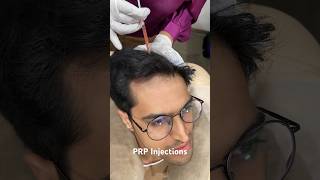 PRP Treatment For Hair loss  Best Hair Regrowth Treatment For Men prptreatment [upl. by Lilahk]