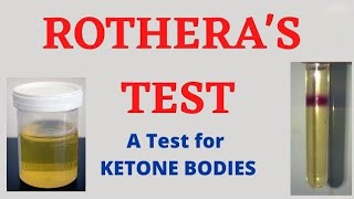 Rotheras Test For Ketone in hindi [upl. by Saxe]