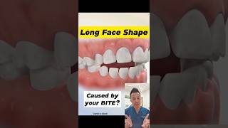 Is Your Bite Giving You a Long Face shorts dentallan dentist [upl. by Rebm]