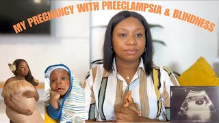 PREGNANCY STORY PREECLAMPSIA CAUSED ME BLINDNESS AND MY RECOVERY birthstory pregnancyjourney [upl. by Lardner]