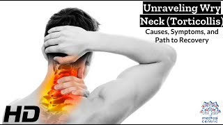 Wry Neck Torticollis The Silent Struggle and How to Overcome It [upl. by Applegate]