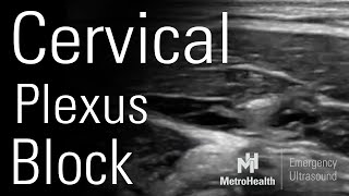 3rd Nerve Palsy Oculomotor Nerve Clinical findings simplified in 35 seconds [upl. by Akemet262]