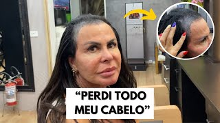 Tudo sobre a queda de cabelo da Gretchen  VEJA A TRASFORMAÇÃO  VÍDEO COMPLETO [upl. by Janey481]