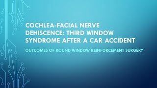 CochleaFacial Nerve Dehiscence Third Window Syndrome After A Car Accident [upl. by Ruder162]