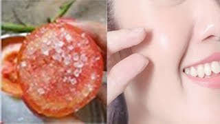 ஒரே நாளில் முகத்தை அசத்தும் வெண்மையாக்குங்கள்  Quick Face Whitening Tips in Tamil Tomato Scrub [upl. by Seniag]