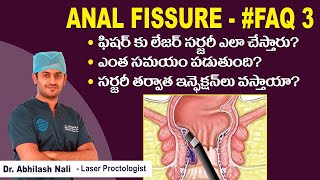 Benefits of Laser Surgery for Fissure  Anal Fissure Treatment in Telugu  Dr Abhilash Nali [upl. by Reynold]