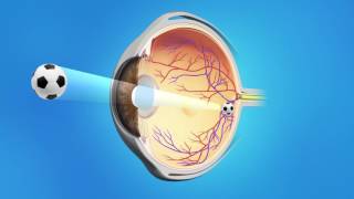 Ophthalmology Cataract surgery  part 1 [upl. by Azaleah843]