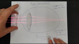 Vision Correction Normal Eyes Myopia Hyperopia Near amp Far Point Lens Power [upl. by Saylor774]