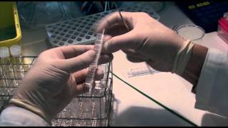 Pulsed Field Gel Electrophoresis PFGE [upl. by Charry377]