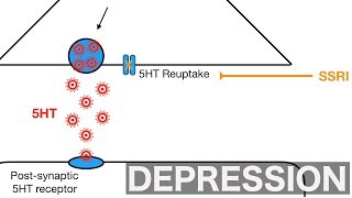 Major Depression and SSRIsSNRIs [upl. by Odele]