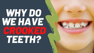 Why do we have crooked teeth  Dentist Explained 2021 [upl. by Attenev800]