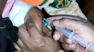 Cefepime 500mg Xemimax amp Amikasin im intramuscular injection Video 24 Ep 116 Injection Tips [upl. by Moriah179]