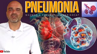 PNEUMONIA o que é Como é o começo da pneumonia O que leva uma pessoa a ter pneumonia [upl. by Eittam]