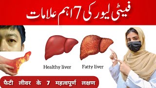 7 important signs of Fatty Liver in UrduHindi  Esha Sajid  Fatty liver ki ilamat fattyliver 1k [upl. by Ivek517]