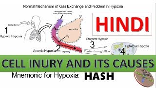 Cell Injury Hypoxia and Causes with Mnemonic in Hindi [upl. by Baggott]