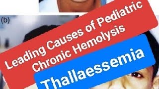 Leading Causes of Pediatric Chronic Hemolysis [upl. by Philpot]