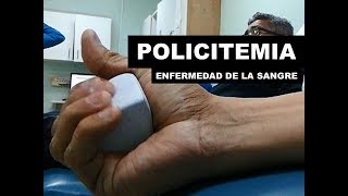 ¿SABES QUÉ ES LA POLICITEMIA VERA [upl. by Akina]