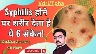 Syphilis के मुख्य लक्षण एवं होने का कारण क्या है Symptoms And Cause Of Syphilis [upl. by Quartas]