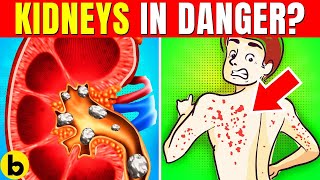 12 ALARMING Signs Your Kidneys May Be In DANGER  KIDNEY DAMAGE SYMPTOMS [upl. by Naujat]