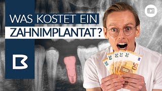 ZahnIMPLANTAT KOSTEN Was muss ICH zahlen Was zahlt die Krankenkasse Alles GENAU erklärt [upl. by Minier]