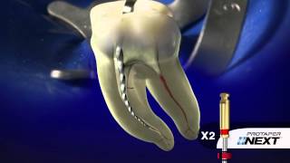 PROTAPER NEXT® Clinical with Dr Ruddle  Dentsply Sirona [upl. by Adnaluoy311]