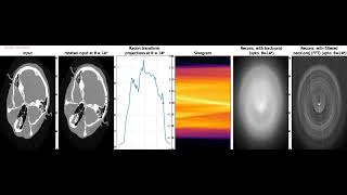 Computed Tomography  Reconstruction  Back Projection  Filtered Back Projection  FFT  python [upl. by Carman]