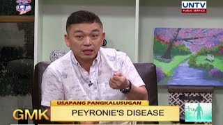 What is Peyronies Disease  Usapang Pangkalusugan [upl. by Naelcm]