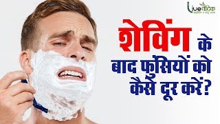 शेविंग के बाद फुंसियों को कैसे दूर करें  Home Remedies For After Shaving Pimples [upl. by Atwahs]