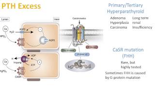 Hypercalcemia and Hypocalcemia [upl. by Ilene]