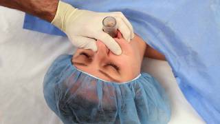 NuMask in Anesthesiology IntraOral Mask IOM®  Oropharyngeal Airway OPA Training Video [upl. by Dnalerb]