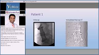 DiscitisOsteomyelitis Lumbar Case Review [upl. by Okomot576]