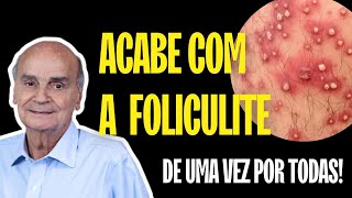 A MELHOR MANEIRA DE ACABAR COM A FOLICULITE DE UMA VEZ POR TODAS SAIBA NESSE VÍDEO [upl. by Ronen]