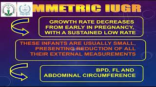 IUGR  Prof Dr Syed Amir Gilani [upl. by Brezin]