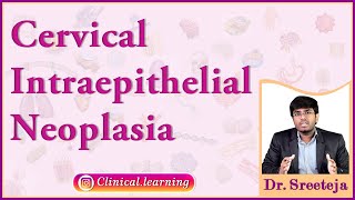 50 Cervical Intraepithelial Neoplasia [upl. by Earal]