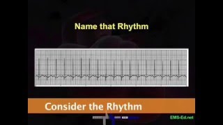 Intro EKG Interpretation Part 2 [upl. by Ayoral647]