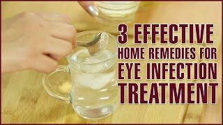 3 Easy amp Effective Home Remedies For EYE INFECTION TREATMENT [upl. by Rehsa]