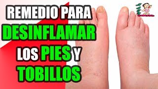 Remedios Caseros Para Desinflamar Los Pies Y Tobillos [upl. by Avlem]