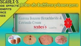 scabexs scabex s cream price scabex s cream for scabies scabex s cream benifits scabex s cream in [upl. by Yelra]