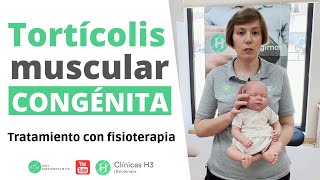 Tratamiento tortícolis muscular congénita 👶 Clínica H3 fisioterapia 2024 [upl. by Farr448]