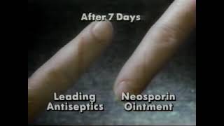 Neosporin Commercial 1991 [upl. by Brass]